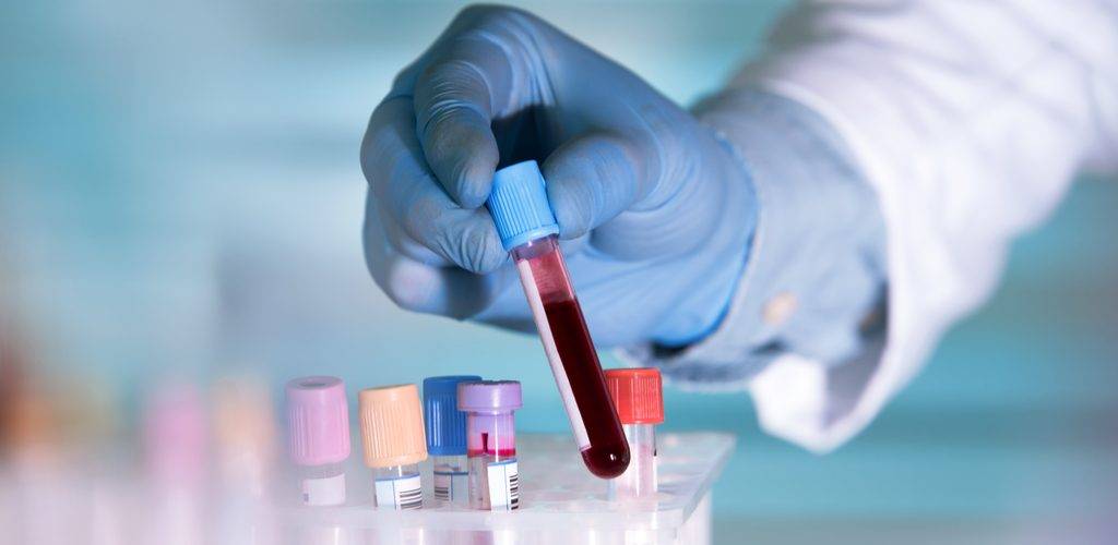 В Ростовской области начнут платные тестирования на антитела к СOVID-19